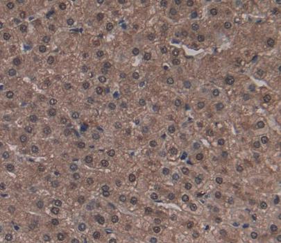 A Disintegrin And Metalloprotease 22 (ADAM22) Polyclonal Antibody - image 4