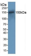 Western Blot; Sample: Recombinant RAD50, Mouse.