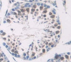DNA Repair Protein RAD50 (RAD50) Polyclonal Antibody - image 4