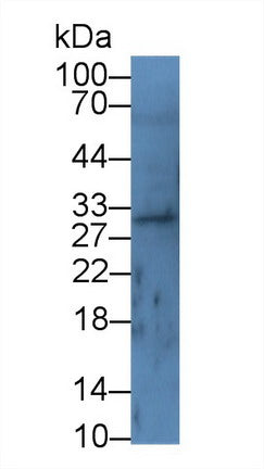 Used in DAB staining on fromalin fixed paraffin-embedded Ovary tissue