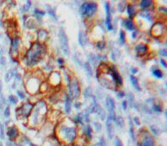 V-Set Domain Containing T-Cell Activation Inhibitor 1 (VTCN1) Polyclonal Antibody - image 4
