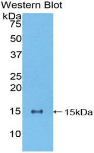 DAB staining on IHC-P; Samples: Human Liver Tissue; Primary Ab: 20μg/ml Rabbit Anti-Human NUMB Antibody Second Ab: 2µg/mL HRP-Linked Caprine Anti-Rabbit IgG Polyclonal Antibody