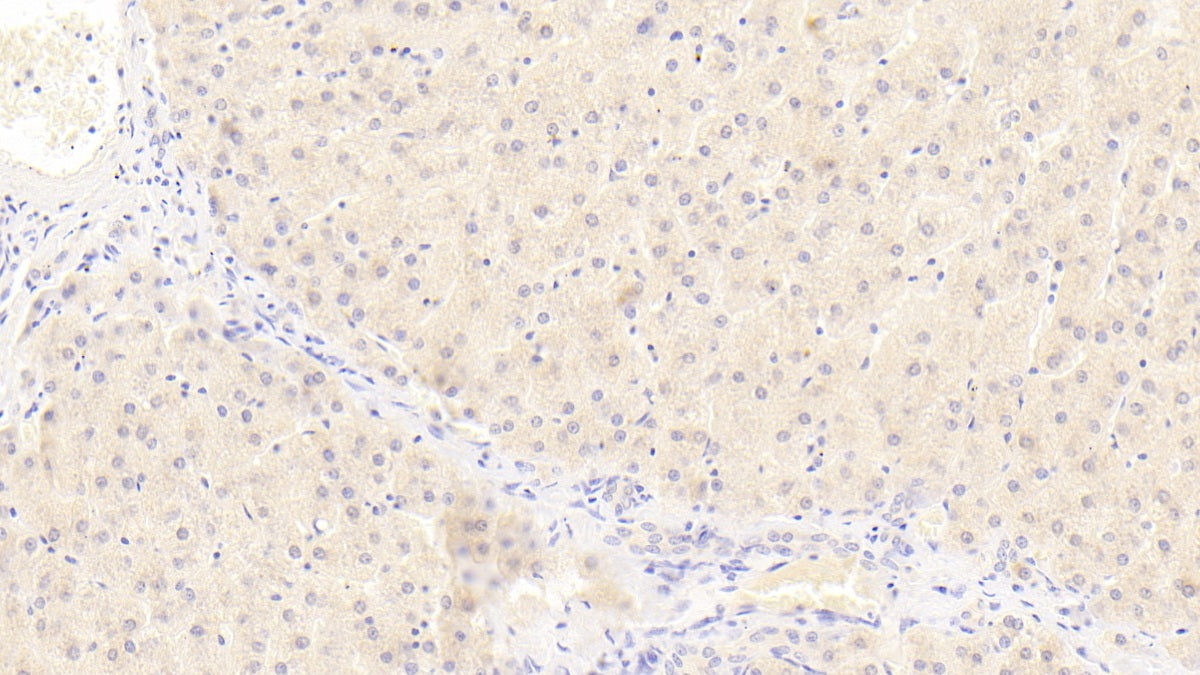 DAB staining on IHC-P. Samples: Human Tissue)