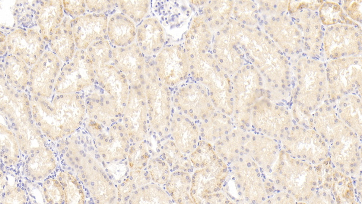 Numb Homolog (NUMB) Polyclonal Antibody - image 5