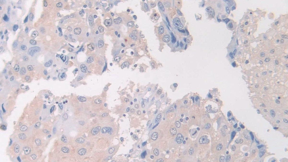 DAB staining on fromalin fixed paraffin- embedded skeletal muscle tissue)