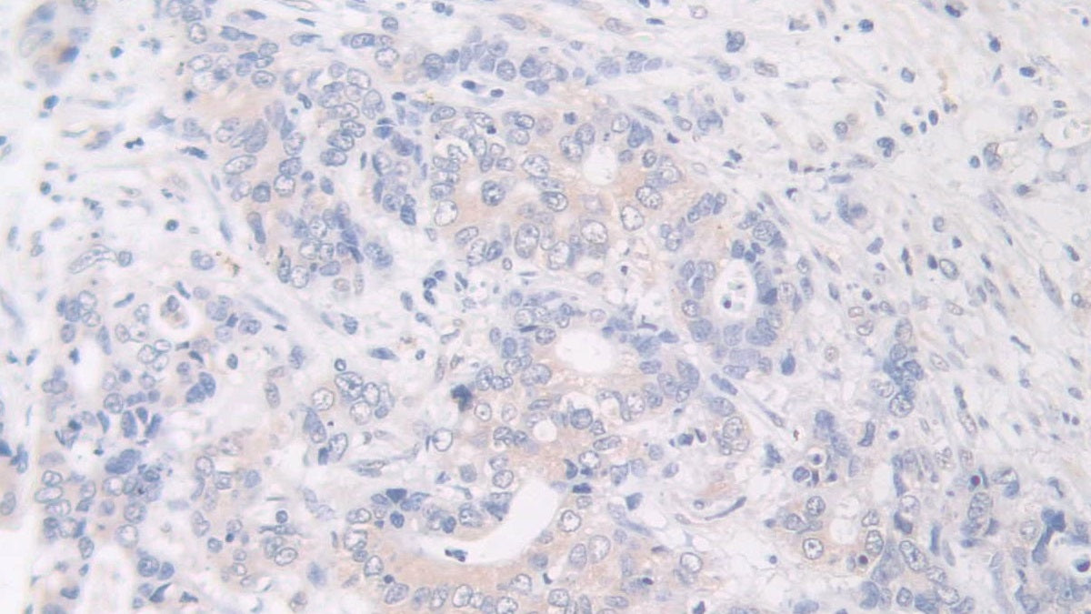 Flightless I Homolog (FLII) Polyclonal Antibody - image 5