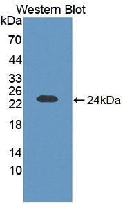 AF4/FMR2 Family, Member 1 (AFF1) Polyclonal Antibody - image 2