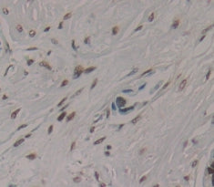 AF4/FMR2 Family, Member 1 (AFF1) Polyclonal Antibody - image 3