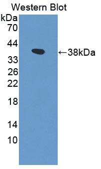 DAB staining on IHC-P; Samples: Human Stomach Tissue;  Primary Ab: 10µg/ml Rabbit Anti-Human PIK3AP1