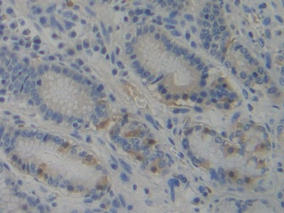 FITC staining on IHC-P; Samples: Human Hela Cells
