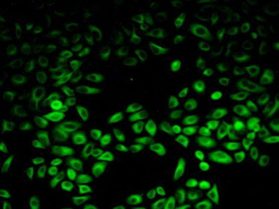 Phosphoinositide-3-Kinase Adaptor Protein 1 (PIK3AP1) Polyclonal Antibody - image 5