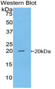 Western Blot; Sample: Lane1: Mouse Liver lysate; Lane2: Mouse Cerebrum lysate; Lane3: Mouse Heart lysate; Primary Ab: 1µg/mL Rabbit Anti-Mouse NME1 Antibody; Second Ab: 0.2µg/mL HRP-Linked Caprine Anti-Rabbit IgG Polyclonal Antibody;