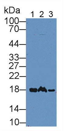 DAB staining on IHC-P; Samples: Mouse Small intestine Tissue; Primary Ab: 30µg/ml Rabbit Anti-Mouse NME1 Antibody Second Ab: 2µg/mL HRP-Linked Caprine Anti-Rabbit IgG Polyclonal Antibody
