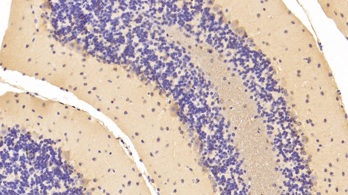 Non Metastatic Cells 1, Protein NM23A Expressed In (NME1) Polyclonal Antibody - image 5