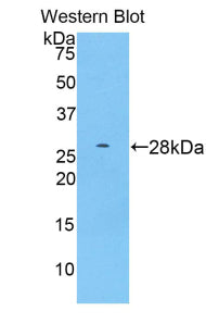 A Disintegrin And Metalloprotease 15 (ADAM15) Polyclonal Antibody - image 2