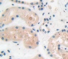 A Disintegrin And Metalloprotease 15 (ADAM15) Polyclonal Antibody - image 3