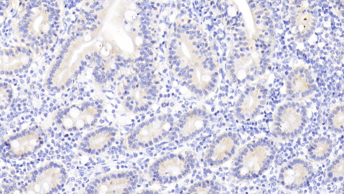 RAB1A, Member RAS Oncogene Family (RAB1A) Polyclonal Antibody - image 3