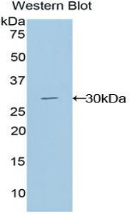 GLI Family Zinc Finger Protein 3 (GLI3) Polyclonal Antibody - image 2