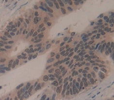 GLI Family Zinc Finger Protein 3 (GLI3) Polyclonal Antibody - image 3