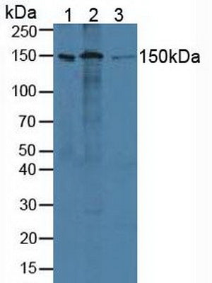 Western Blot; Sample: Recombinant ADNP, Human.