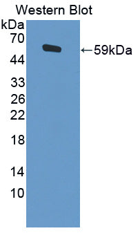 Activity Dependent Neuroprotector Protein (ADNP) Polyclonal Antibody - image 3