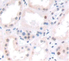 Activity Dependent Neuroprotector Protein (ADNP) Polyclonal Antibody - image 4