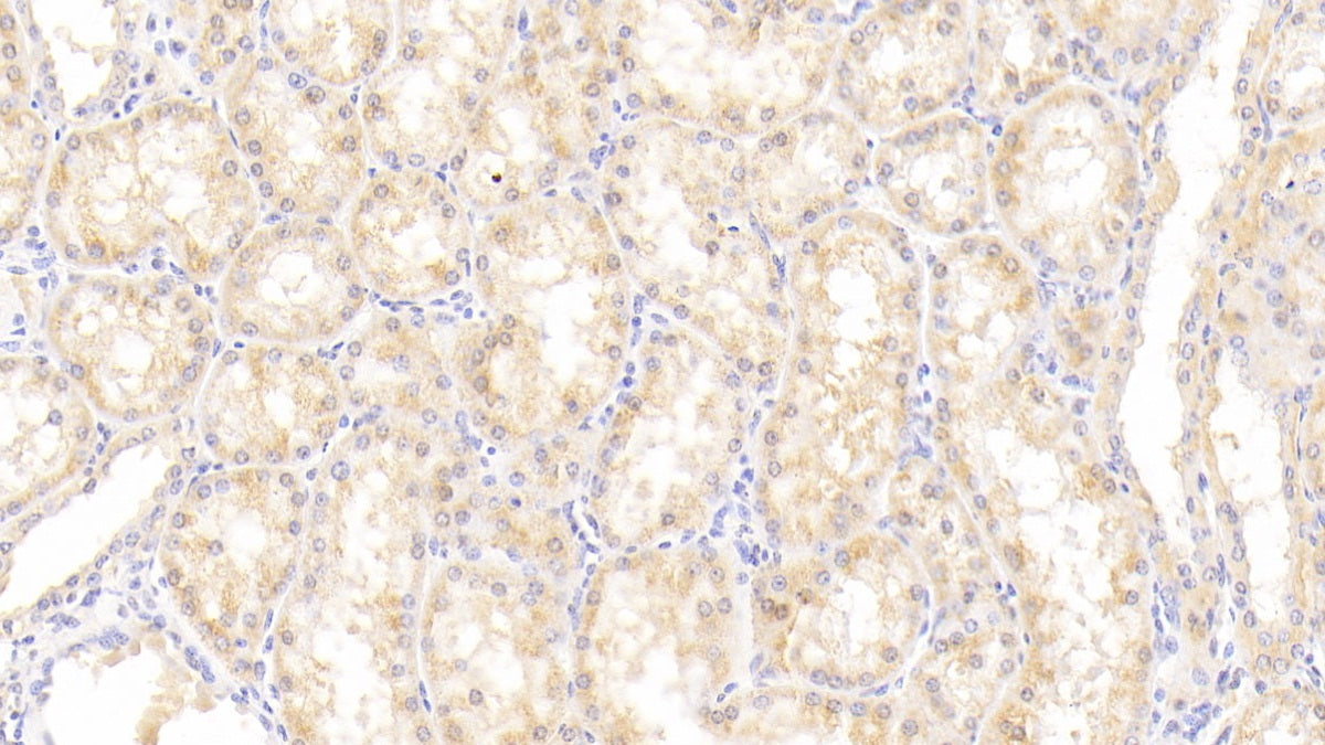 DAB staining on fromalin fixed paraffin-embedded liver tissue)