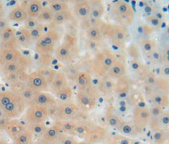 Agmatine Ureohydrolase (AGMAT) Polyclonal Antibody - image 5