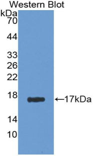 DAB staining on IHC-P; Samples: Human Kidney Tissue; Primary Ab: 20μg/ml Rabbit Anti-Human AGMAT Antibody Second Ab: 2µg/mL HRP-Linked Caprine Anti-Rabbit IgG Polyclonal Antibody