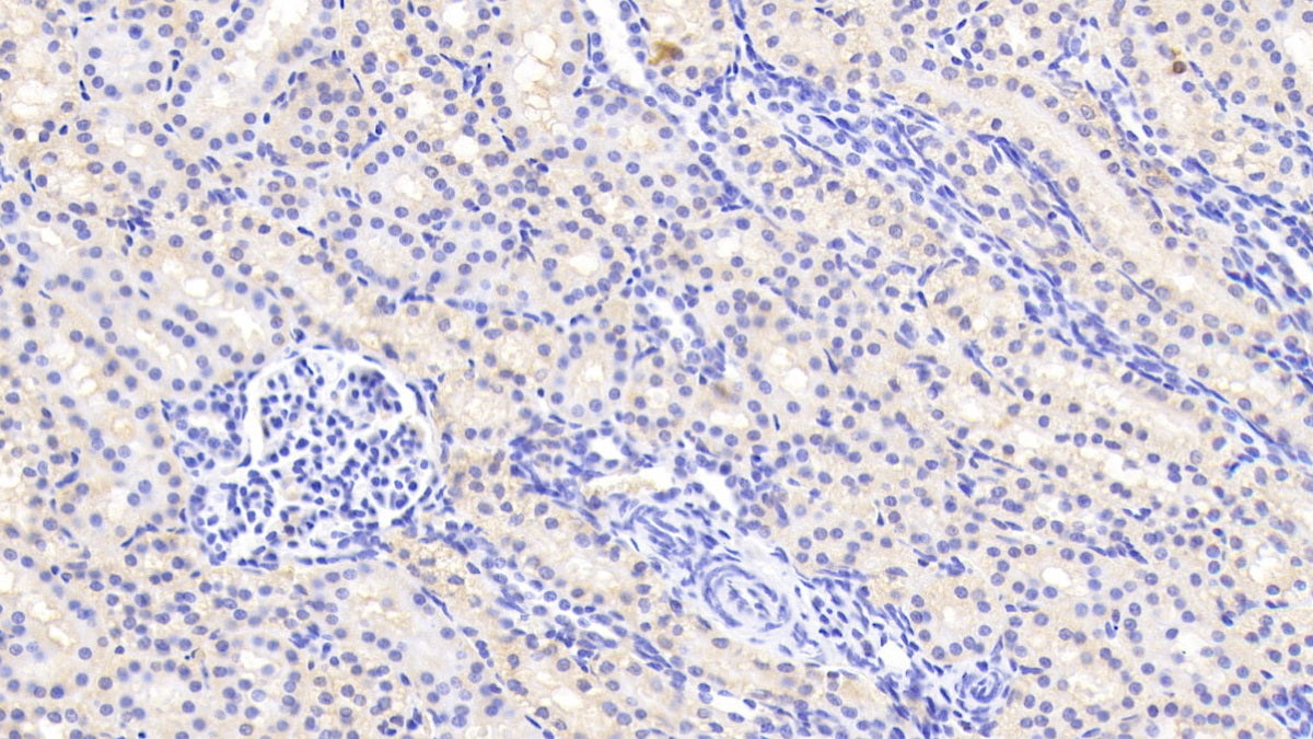DAB staining on fromalin fixed paraffin-embedded kidney tissue)