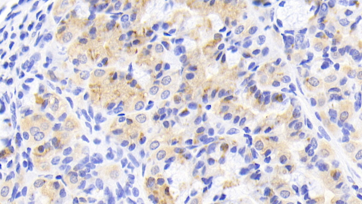Agmatine Ureohydrolase (AGMAT) Polyclonal Antibody - image 5