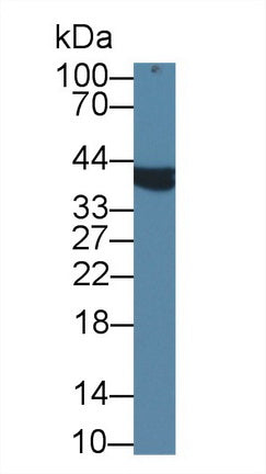 Alpha-Methylacyl Coenzyme A Racemase (aMACR) Polyclonal Antibody - image 2