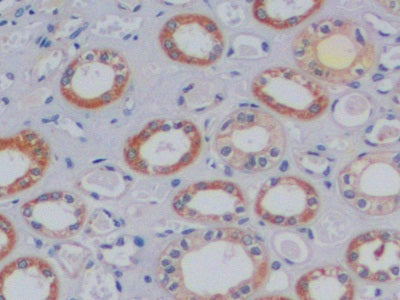 DAB staining on IHC-P; Samples: Human Prostate Tissue;  Primary Ab: 10µg/ml Rabbit Anti-Human aMACR
