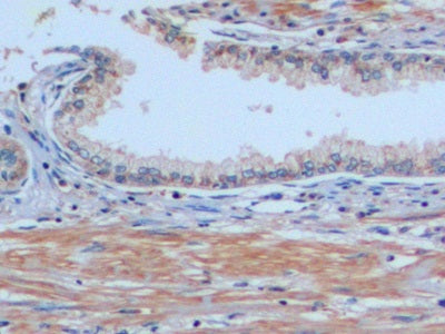 Alpha-Methylacyl Coenzyme A Racemase (aMACR) Polyclonal Antibody - image 4