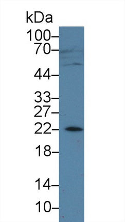 Western Blot; Sample: Recombinant protein.