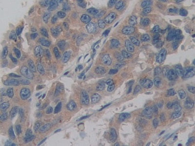 DAB staining on fromalin fixed paraffin- embedded liver tissue)