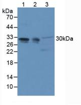 Knockout Varification: <br/>Lane 1: Wild-type Hela cell lysate; <br/>Lane 2: ANP32A knockout Hela cell lysate; <br/>Predicted MW: 29kd <br/>Observed MW: 35kd<br/>Primary Ab: 1µg/ml Rabbit Anti-Human ANP32A Antibody<br/>Second Ab: 0.2µg/mL HRP-Linked Caprine Anti-Rabbit IgG Polyclonal Antibody<br/>