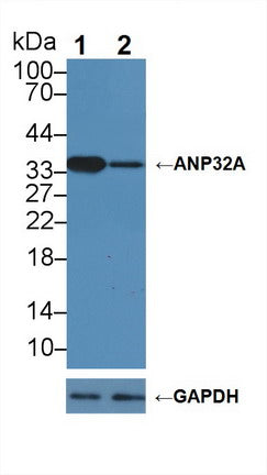 DAB staining on IHC-P; Samples: Human Cerebrum Tissue; Primary Ab: 20μg/ml Rabbit Anti-Human ANP32A Antibody Second Ab: 2µg/mL HRP-Linked Caprine Anti-Rabbit IgG Polyclonal Antibody