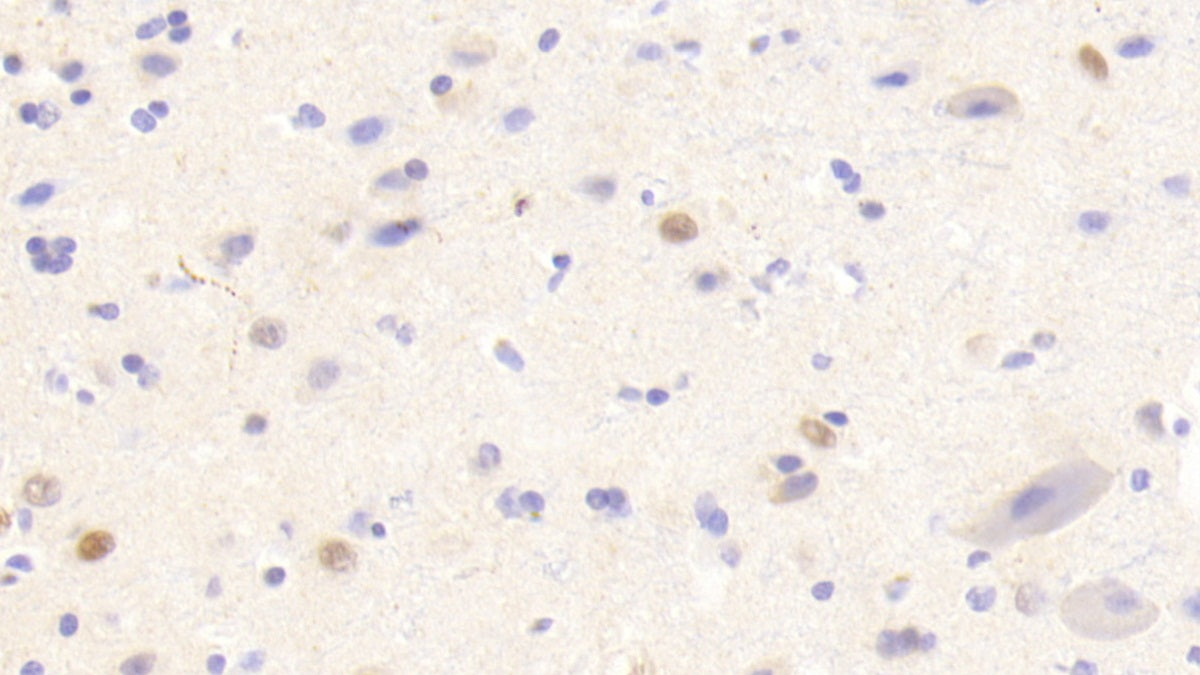 DAB staining on fromalin fixed paraffin-embedded Kidney tissue)