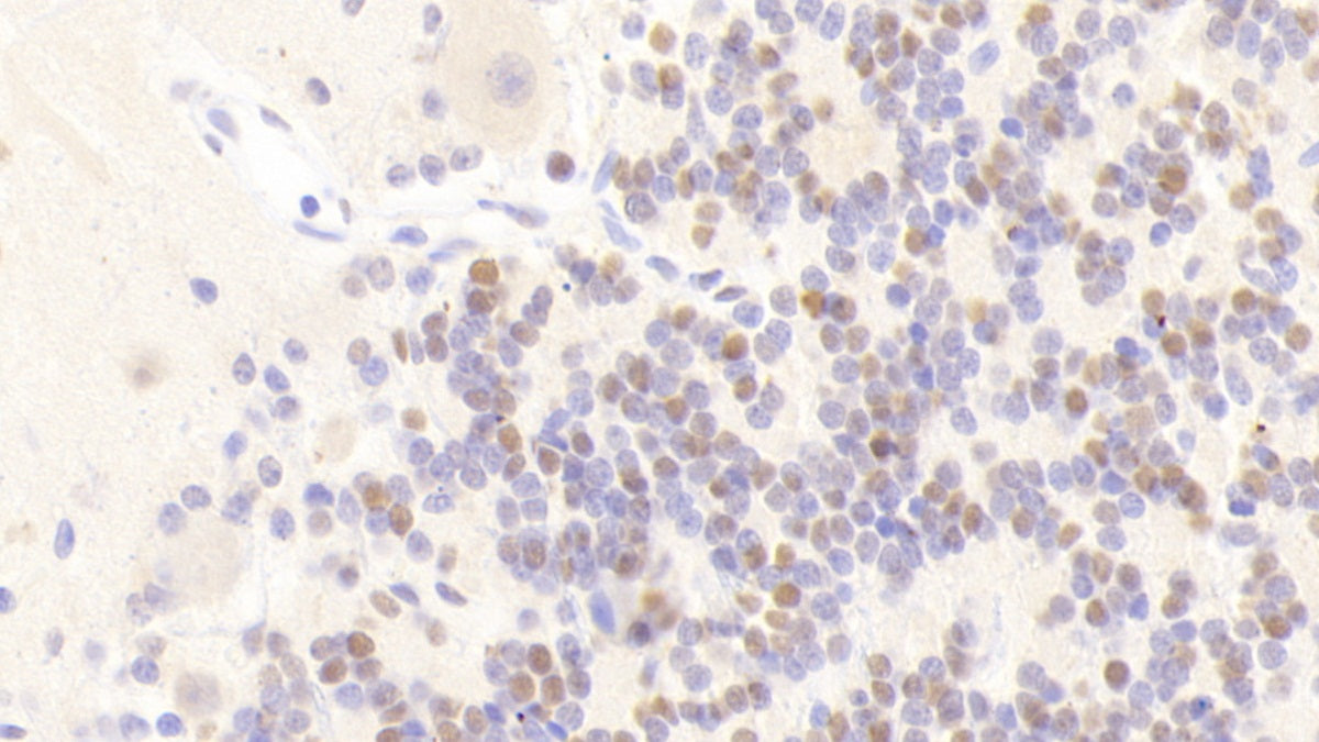 Acidic Nuclear Phosphoprotein 32 Family, Member A (ANP32A) Polyclonal Antibody - image 5