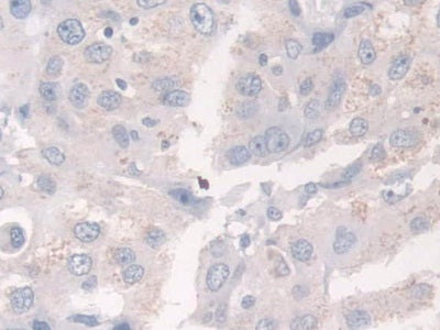 DAB staining on fromalin fixed paraffin- embedded pancreas tissue)