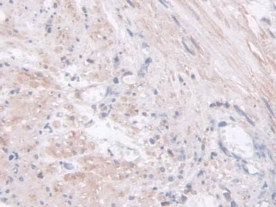 Acyloxyacyl Hydrolase (AOAH) Polyclonal Antibody - image 5
