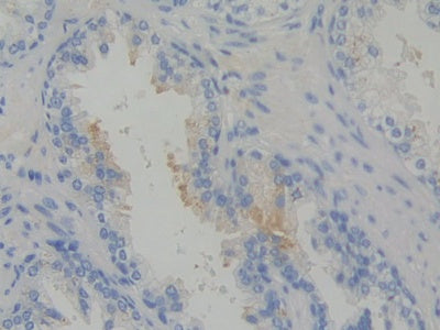 DAB staining on IHC-P; Samples: Human Prostate Tissue