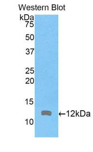 Actin Related Protein 2/3 Complex Subunit 4 (ARPC4) Polyclonal Antibody - image 2