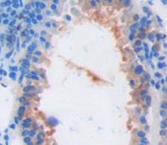 Actin Related Protein 2/3 Complex Subunit 4 (ARPC4) Polyclonal Antibody - image 3
