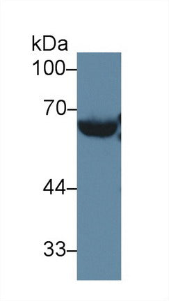 Western Blot; Sample: Recombinant protein.