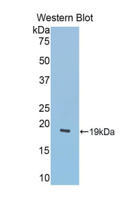 DAB staining on IHC-P; Samples: Mouse Liver Tissue;  Primary Ab: 20µg/ml Rabbit Anti-Mouse LCAT Antibody Second Ab: 2µg/mL HRP-Linked Caprine Anti-Rabbit IgG Polyclonal Antibody