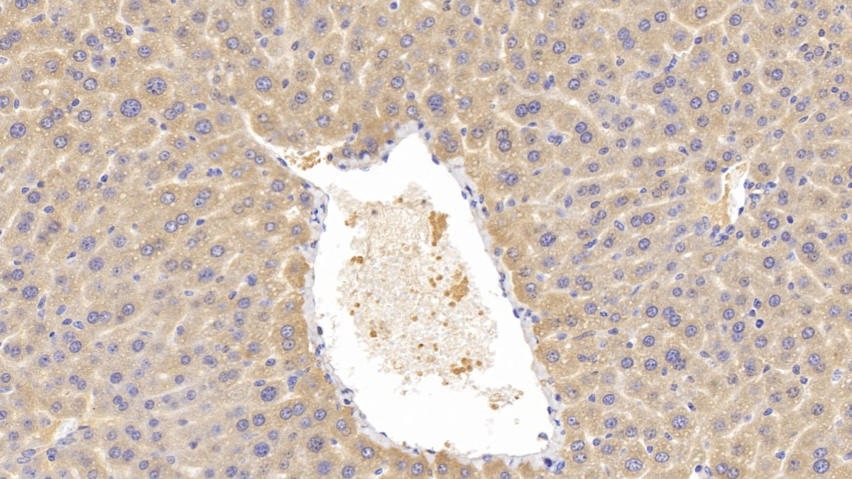 Lecithin Cholesterol Acyltransferase (LCAT) Polyclonal Antibody - image 4