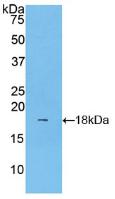 Lecithin Cholesterol Acyltransferase (LCAT) Polyclonal Antibody - image 2