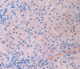 Lecithin Cholesterol Acyltransferase (LCAT) Polyclonal Antibody - image 4